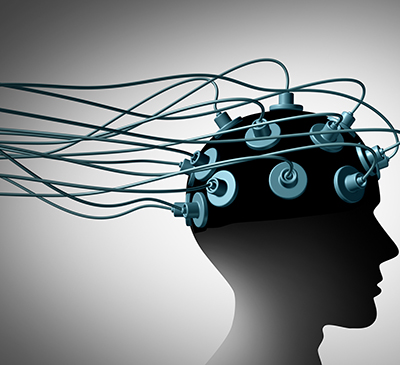 Global Deep Brain Stimulation Devices Market 2018-2022